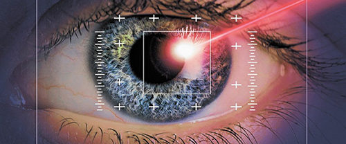 Основные плюсы и минусы лазерной коррекции зрения