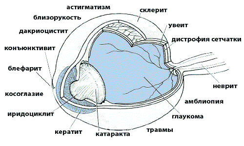 Болезни глаз у человека
